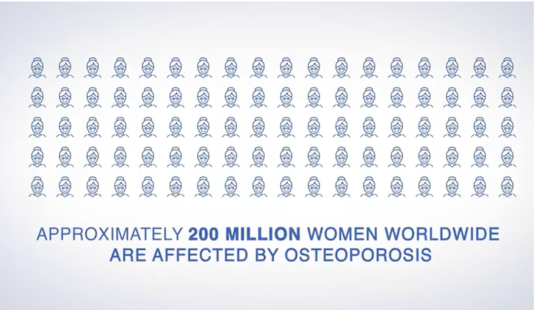 The Prevalence of Osteoporosis